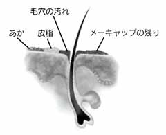 毛根の模式図