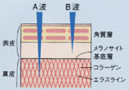 紫外線A波とB波とお肌について